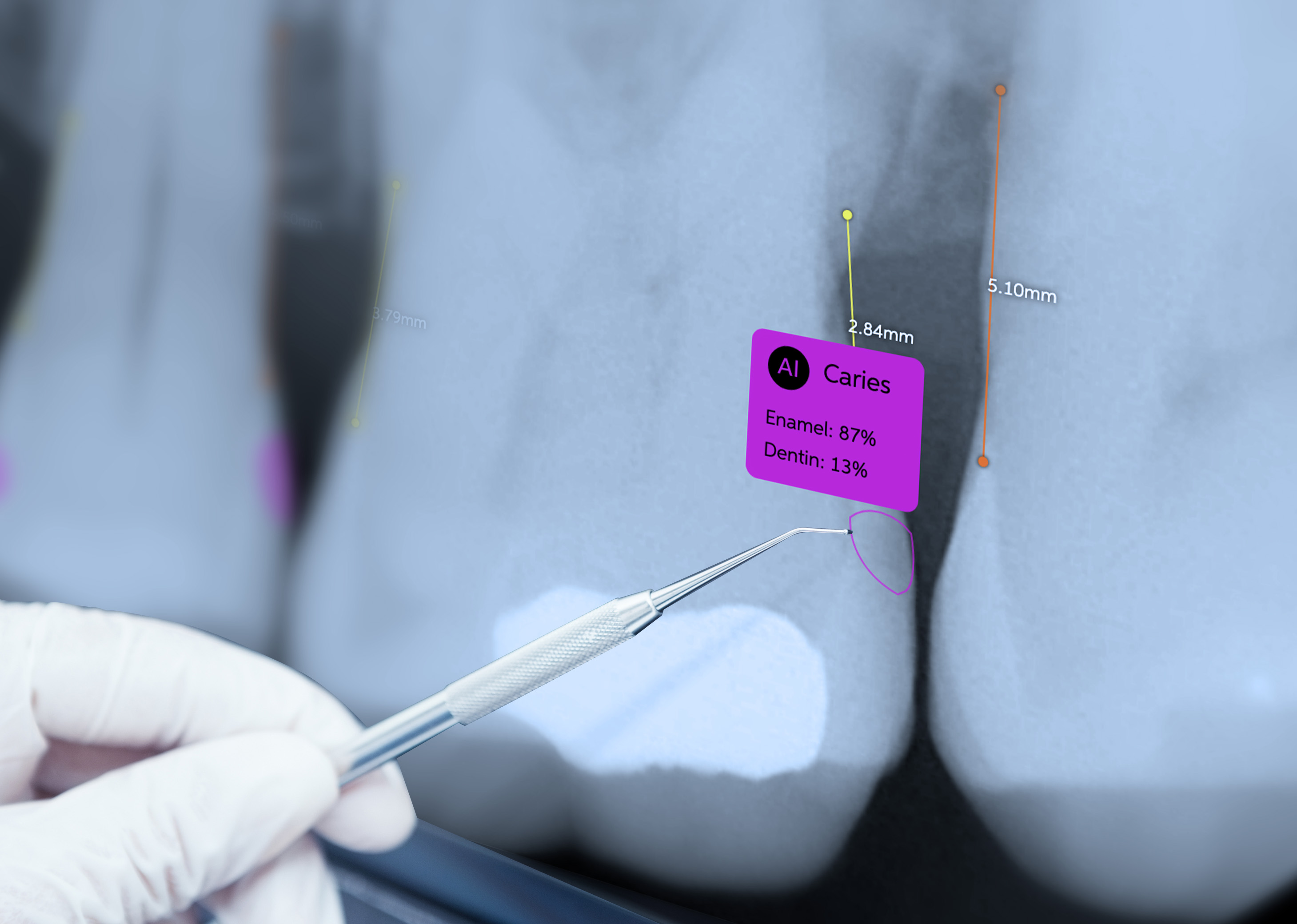 AI in Dentistry A Gentle Revolution